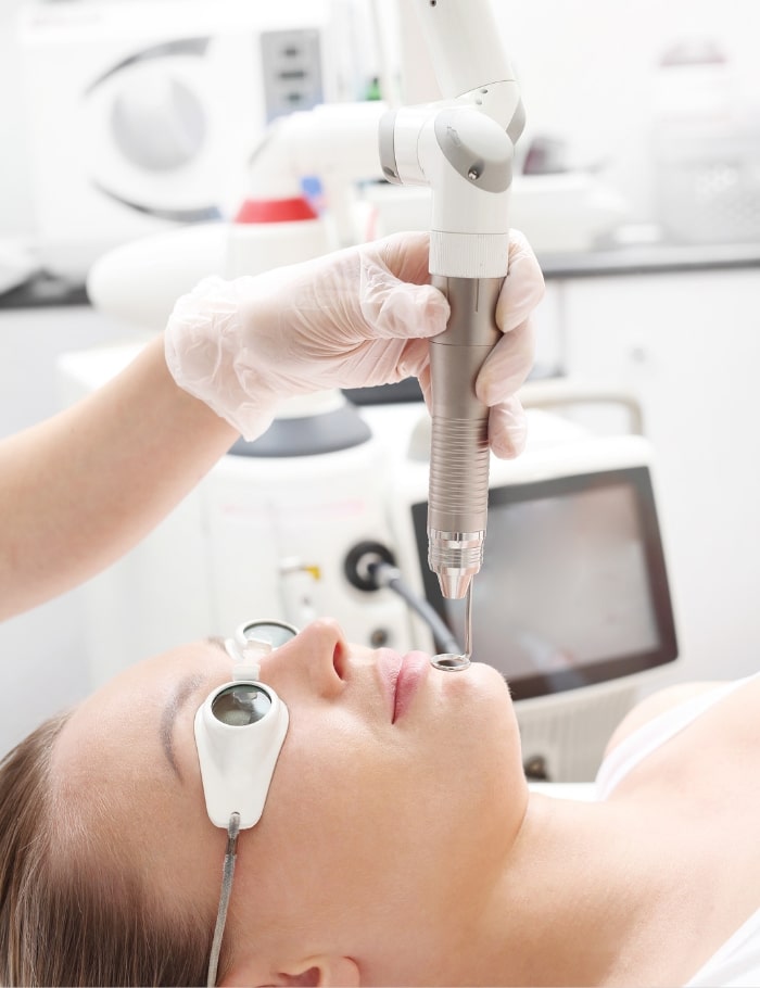 Laser Face Lift