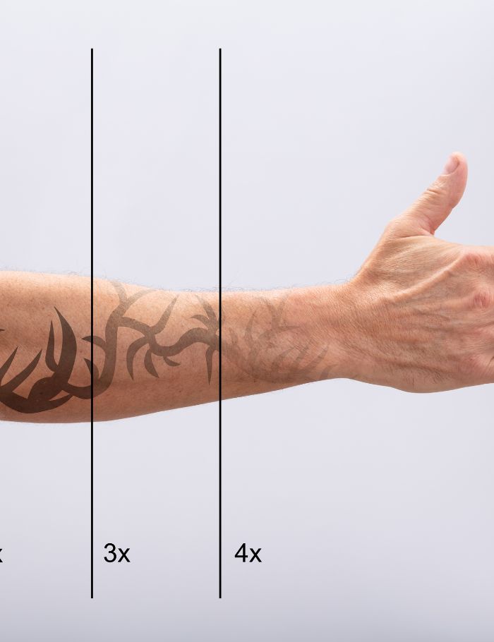 picoway for tattoo removal