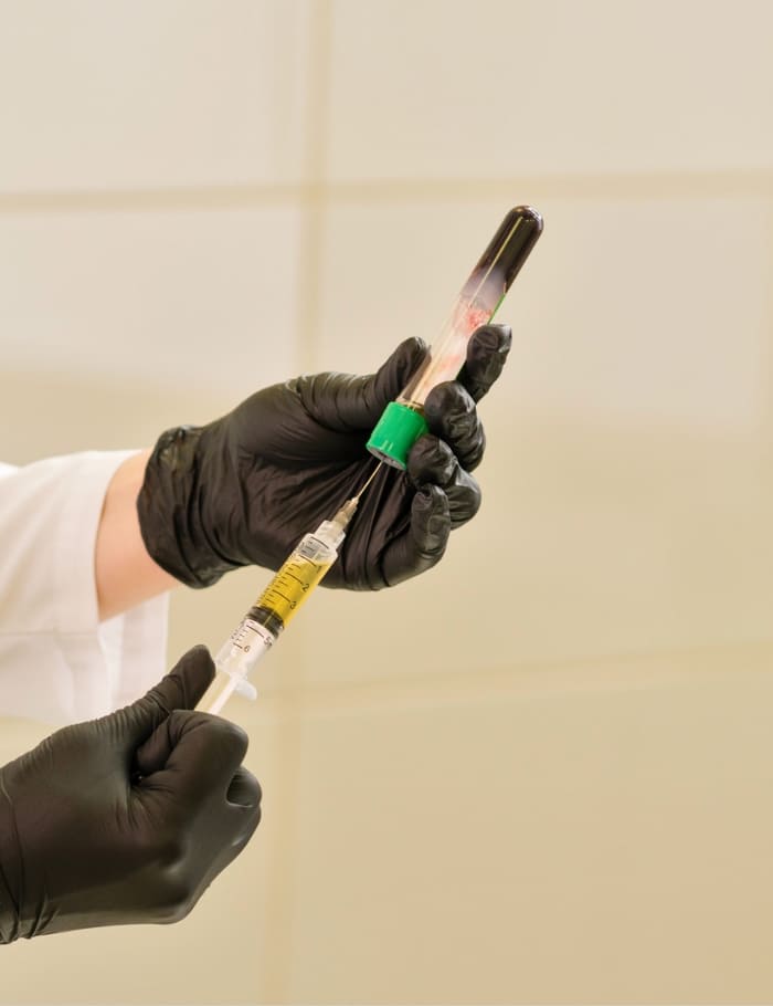 extract platelet for prp treatment