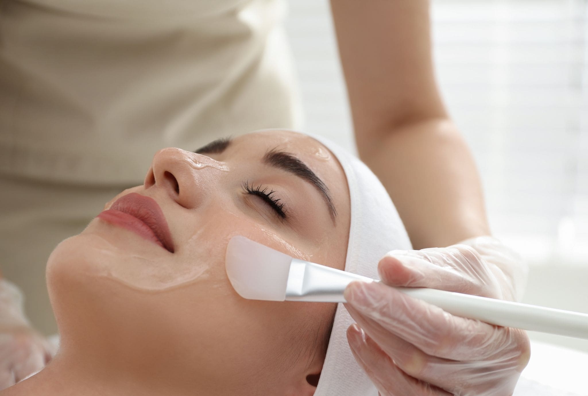 medical peel treatment