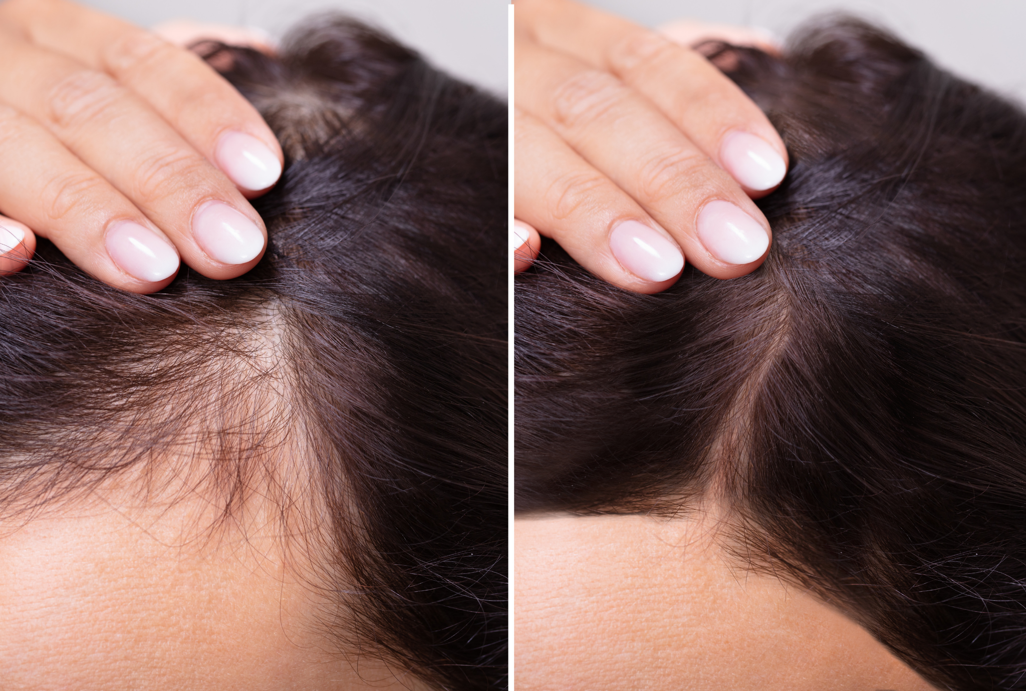 laser hair stimulation dat hortman clinics