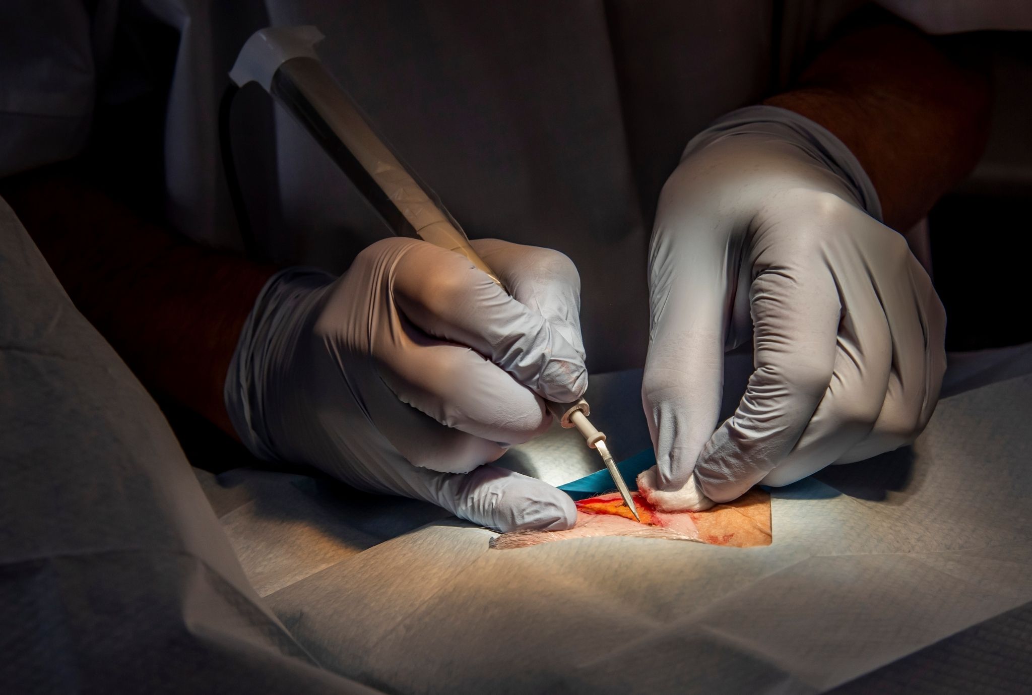 Dermatologist doing treatment