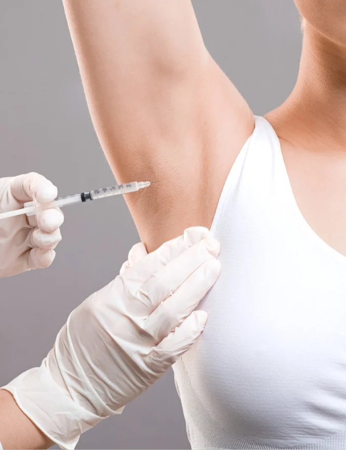 excessive sweating treatment for under arm