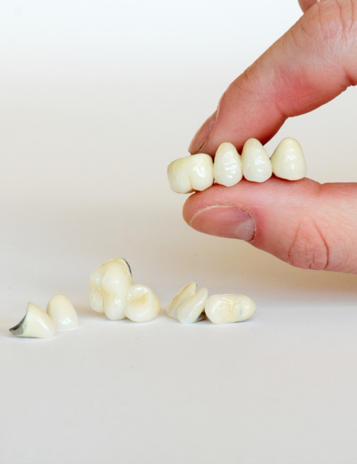 bridge treatment dubai