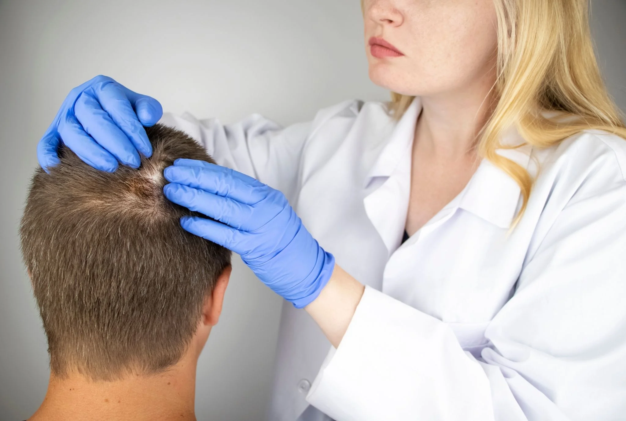 Alopecia treatment at hortman clinics