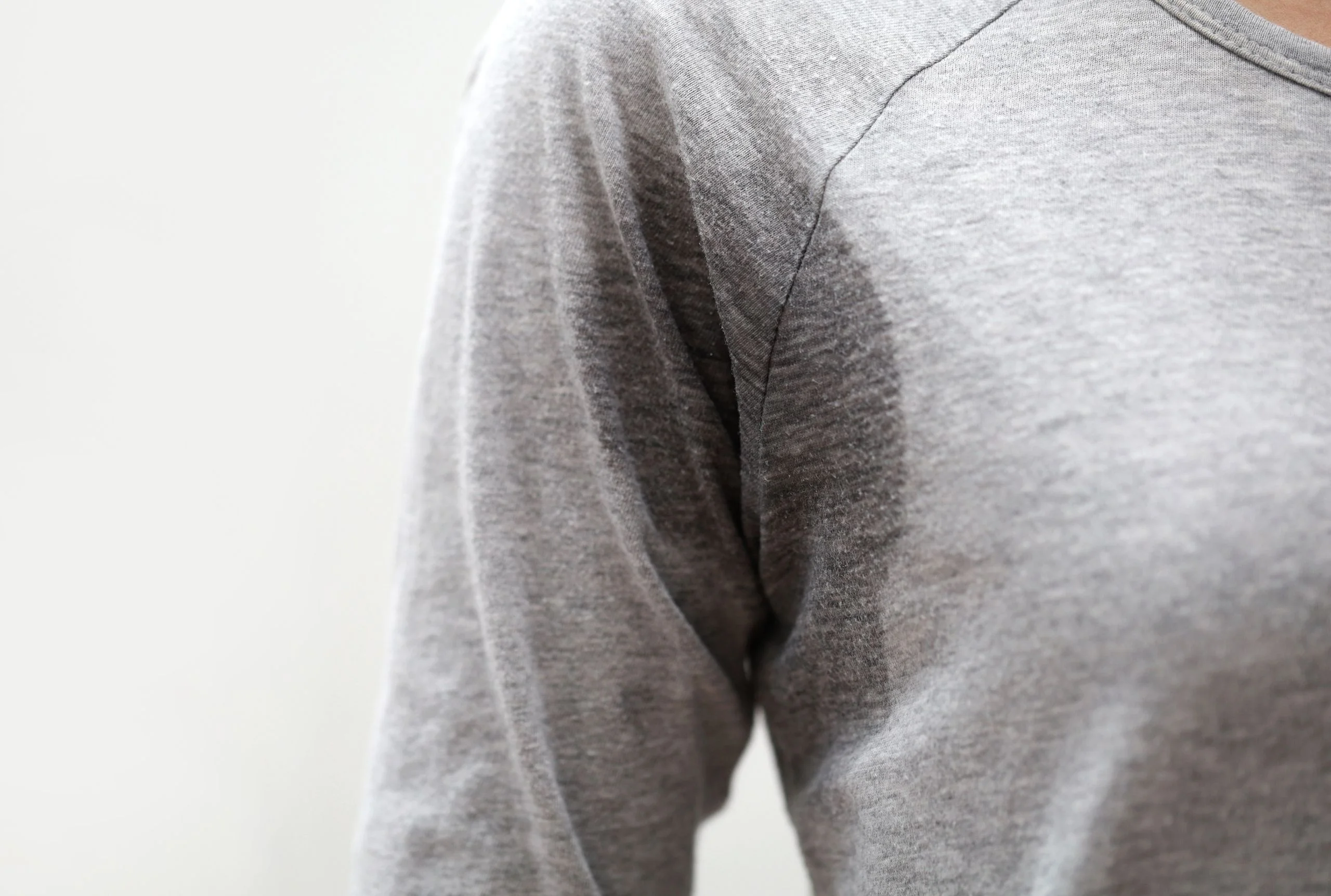 excessive sweating treatment for under arms