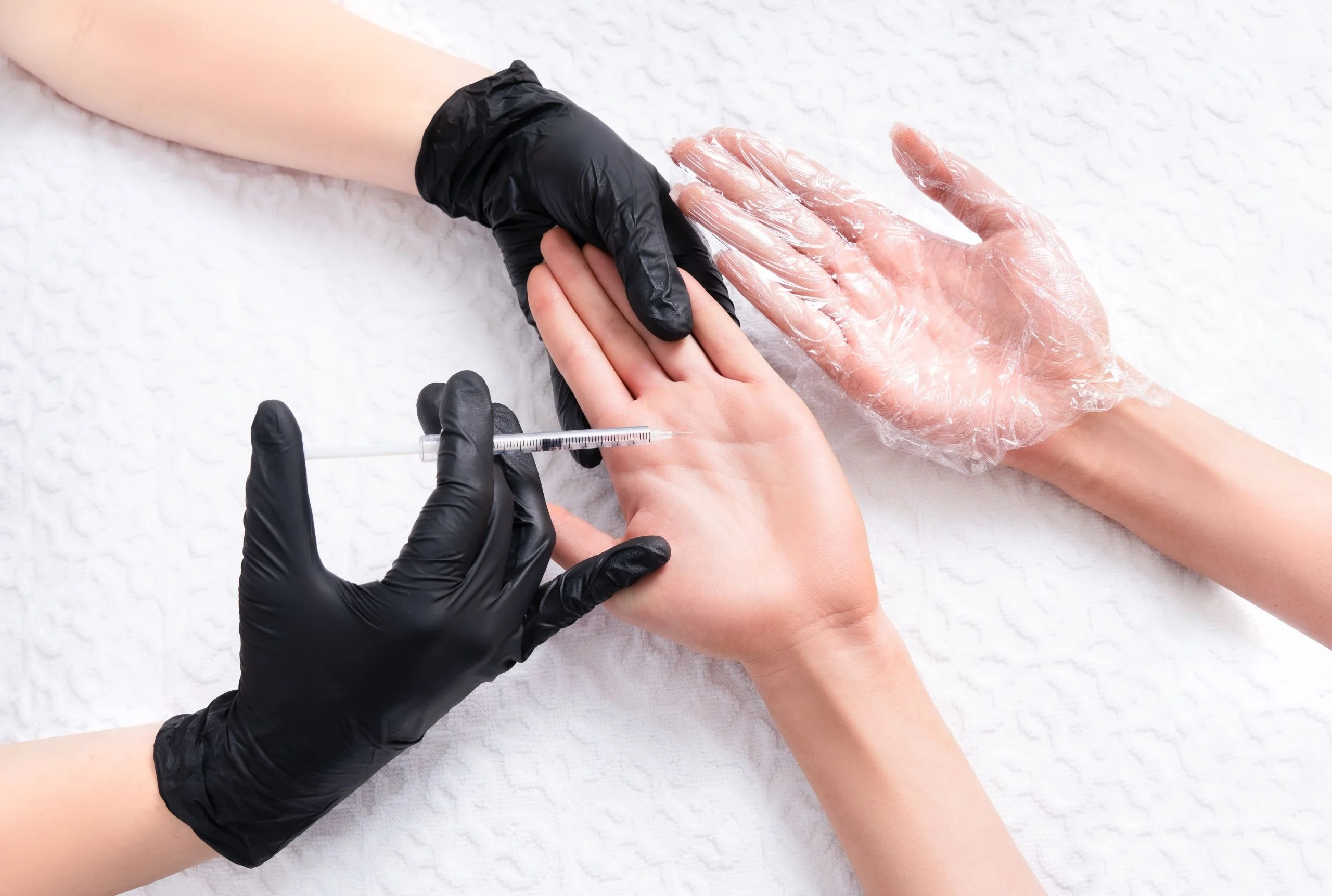 excessive sweating treatment for palm hand