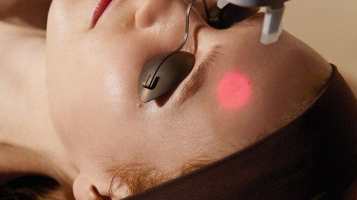 laser skin treatment