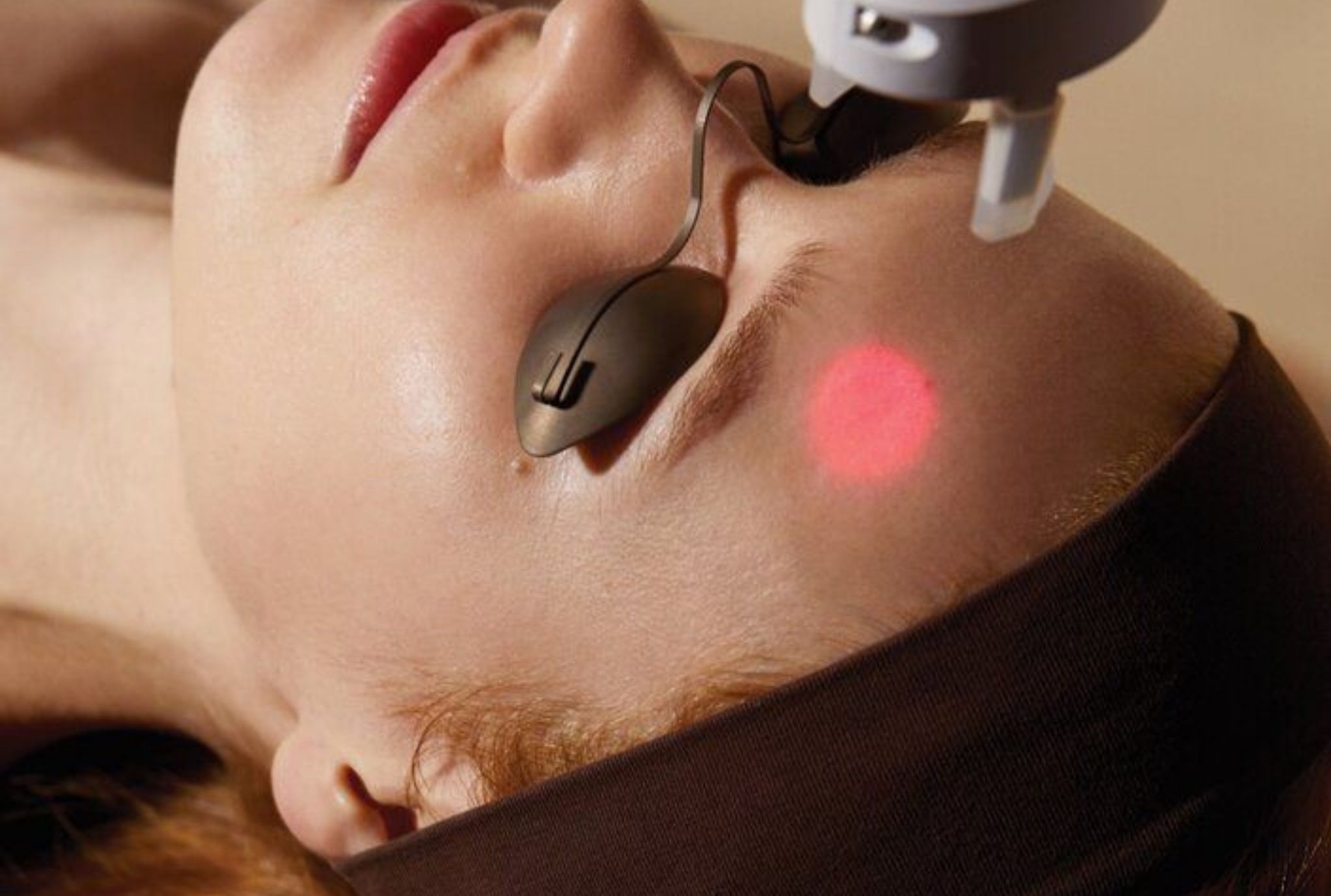 laser skin treatment