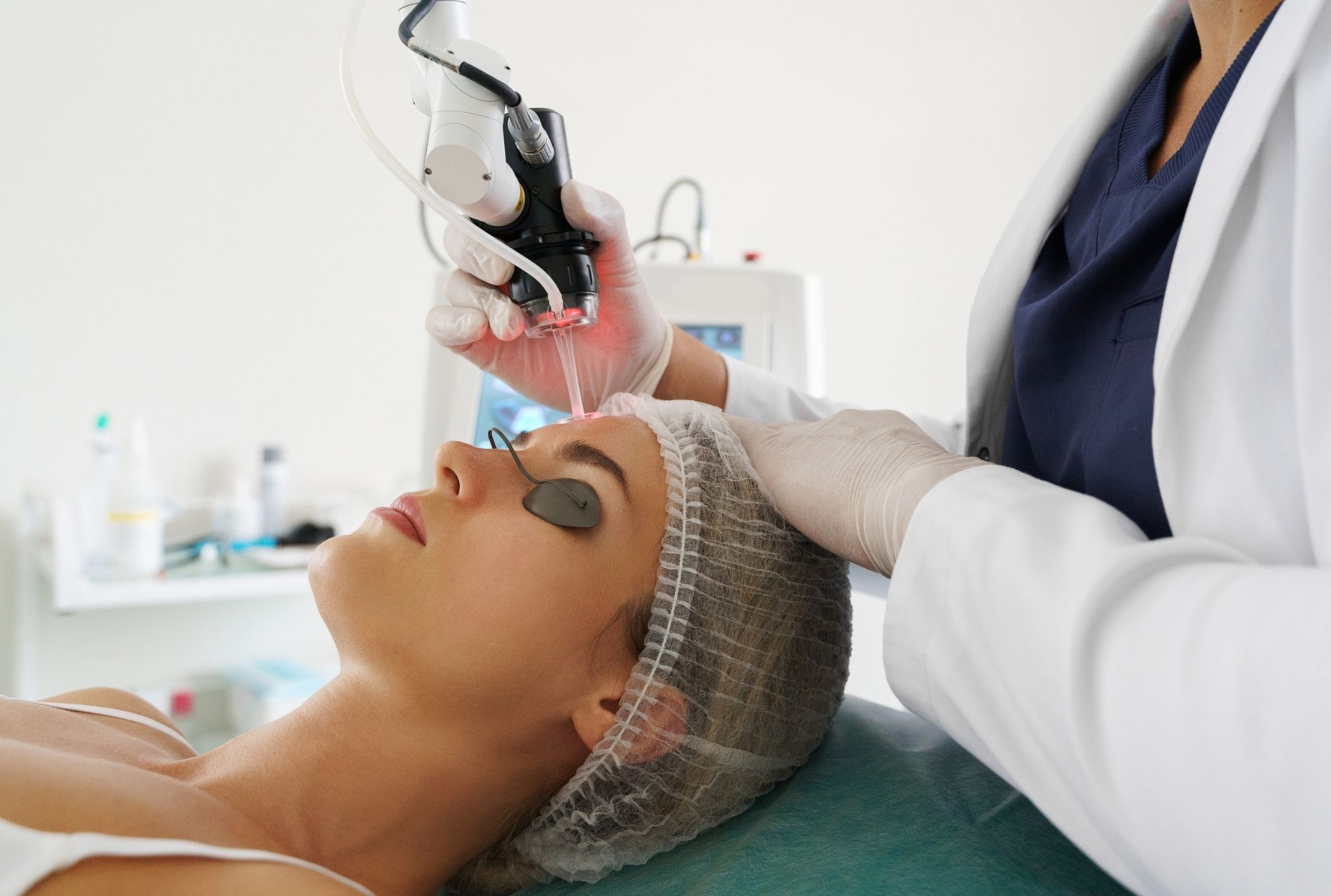 laser treatment for skin