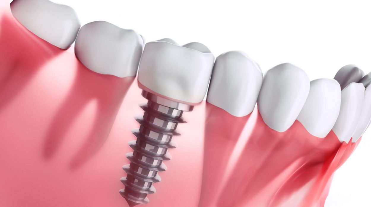 dental implant dubai