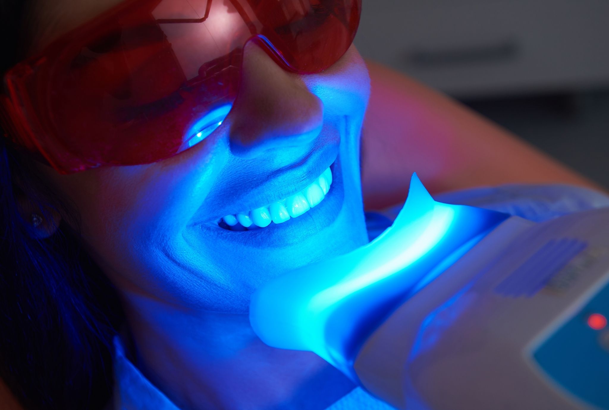 Philips zoom teeth whitening