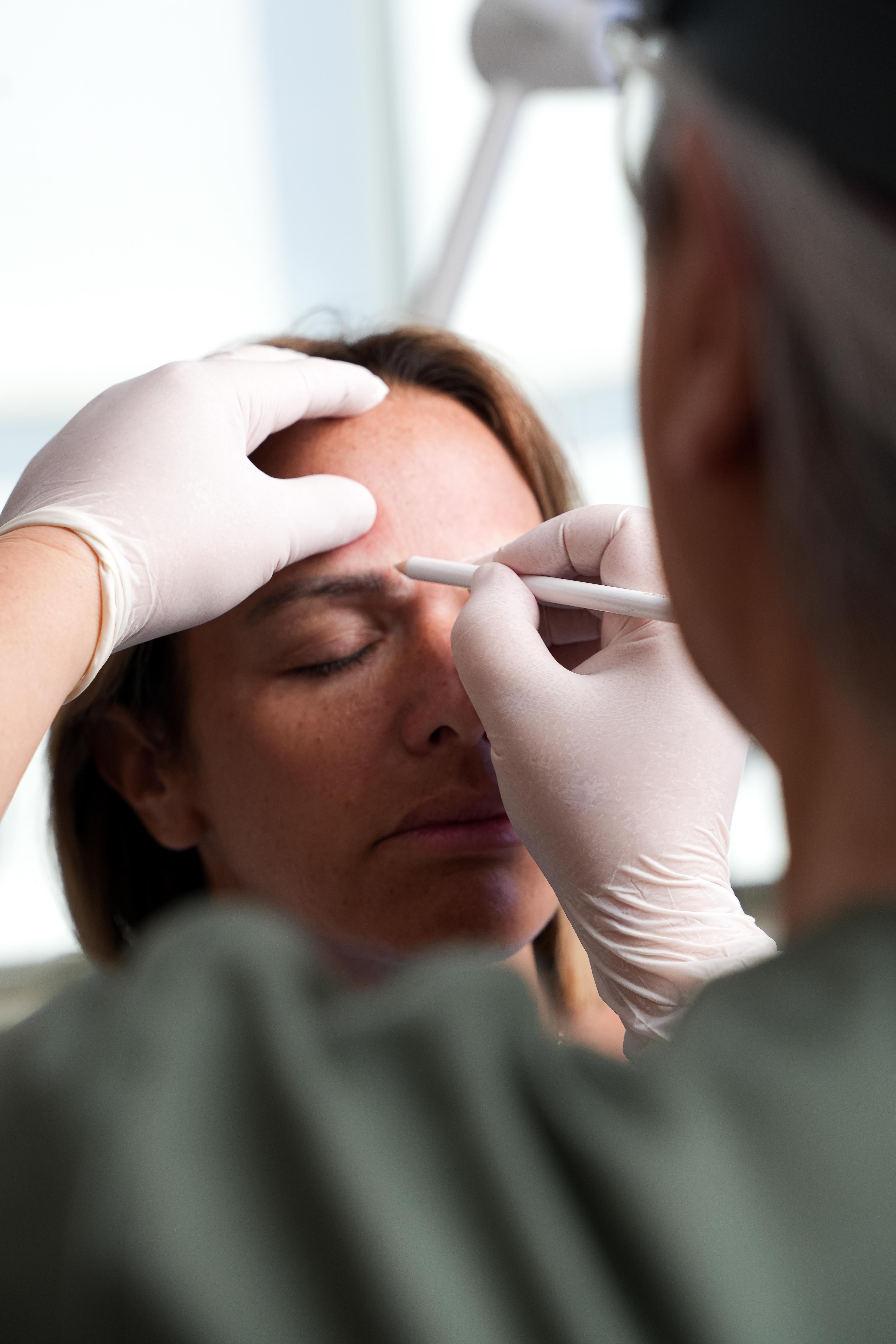 eyebrow transplant