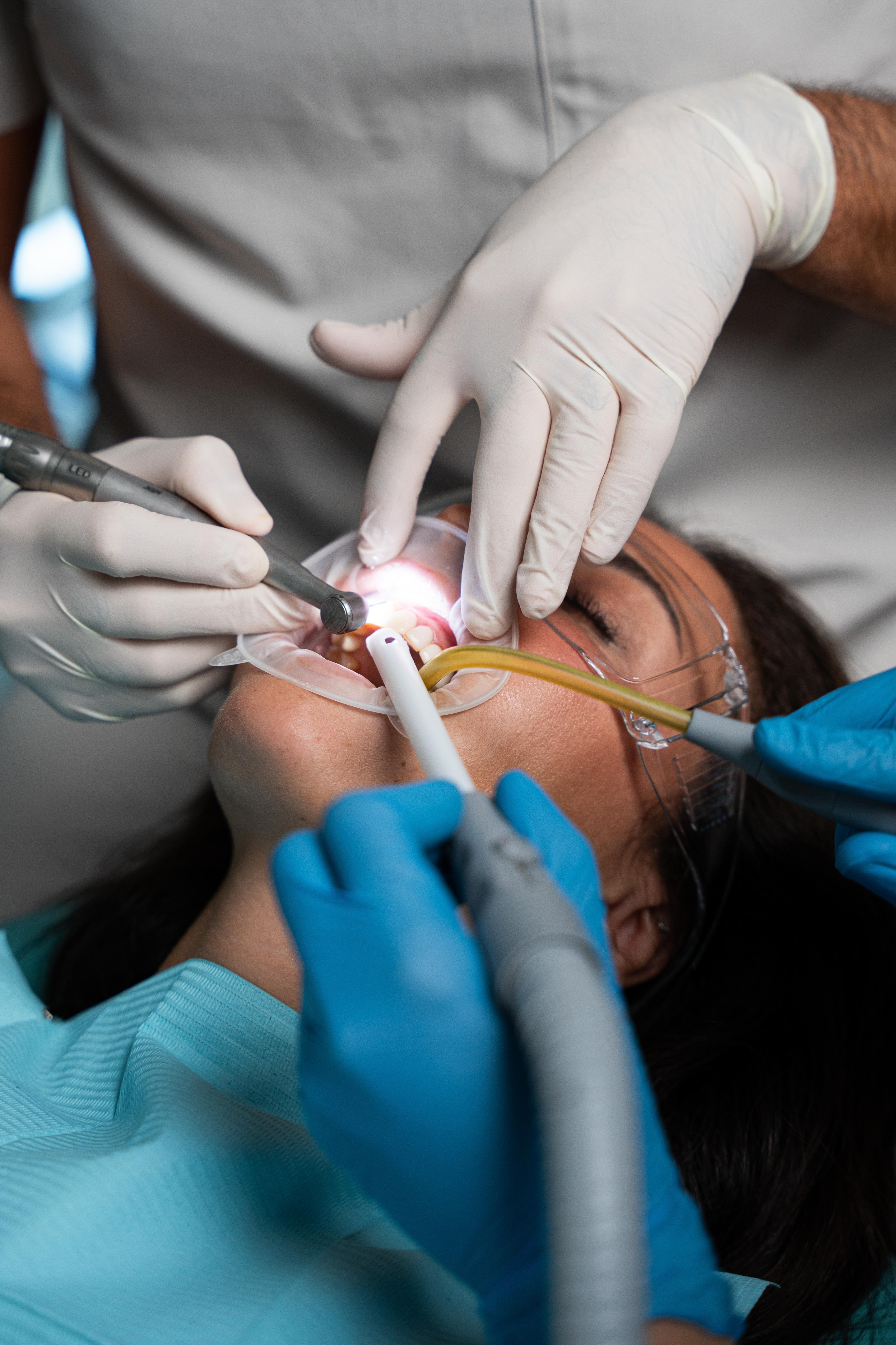 gum bleaching treatment