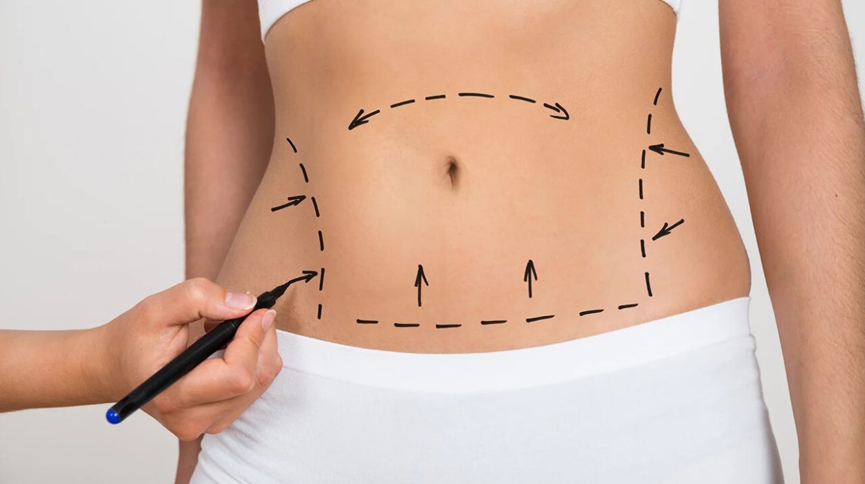 liposuction treatment dubai