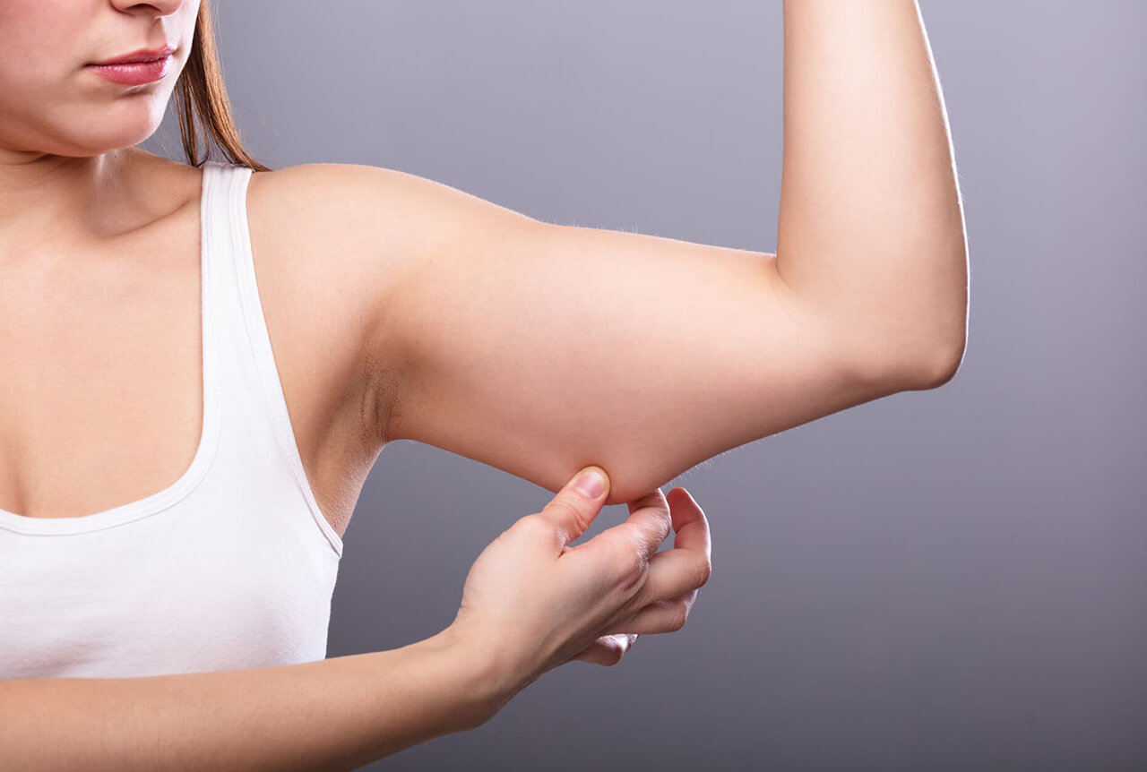 Arm Lift Surgery