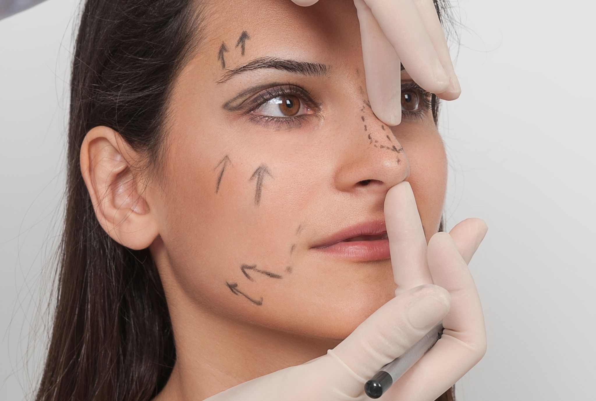 Rhinoplasty Surgery