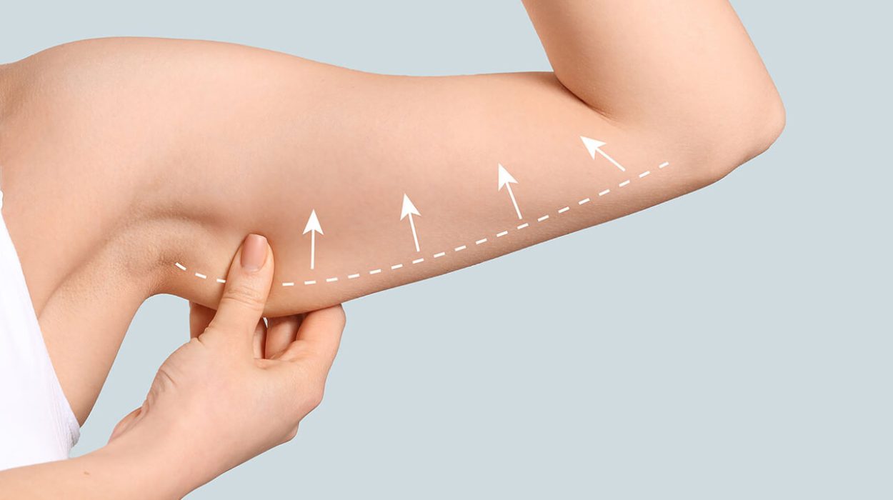 Arm Lift Surgery