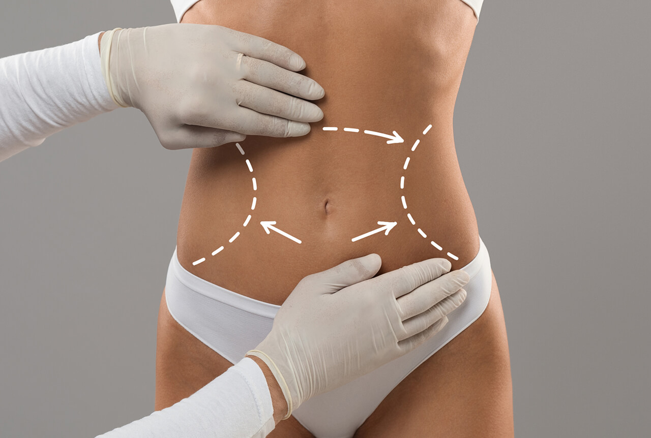 liposuction dubai