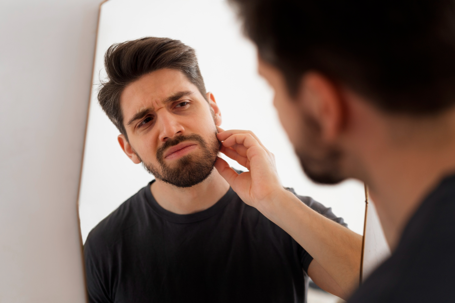 Beard Transplant Aftercare Guide
