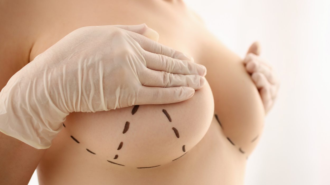 What to Expect During Your Breast Augmentation Recovery Process