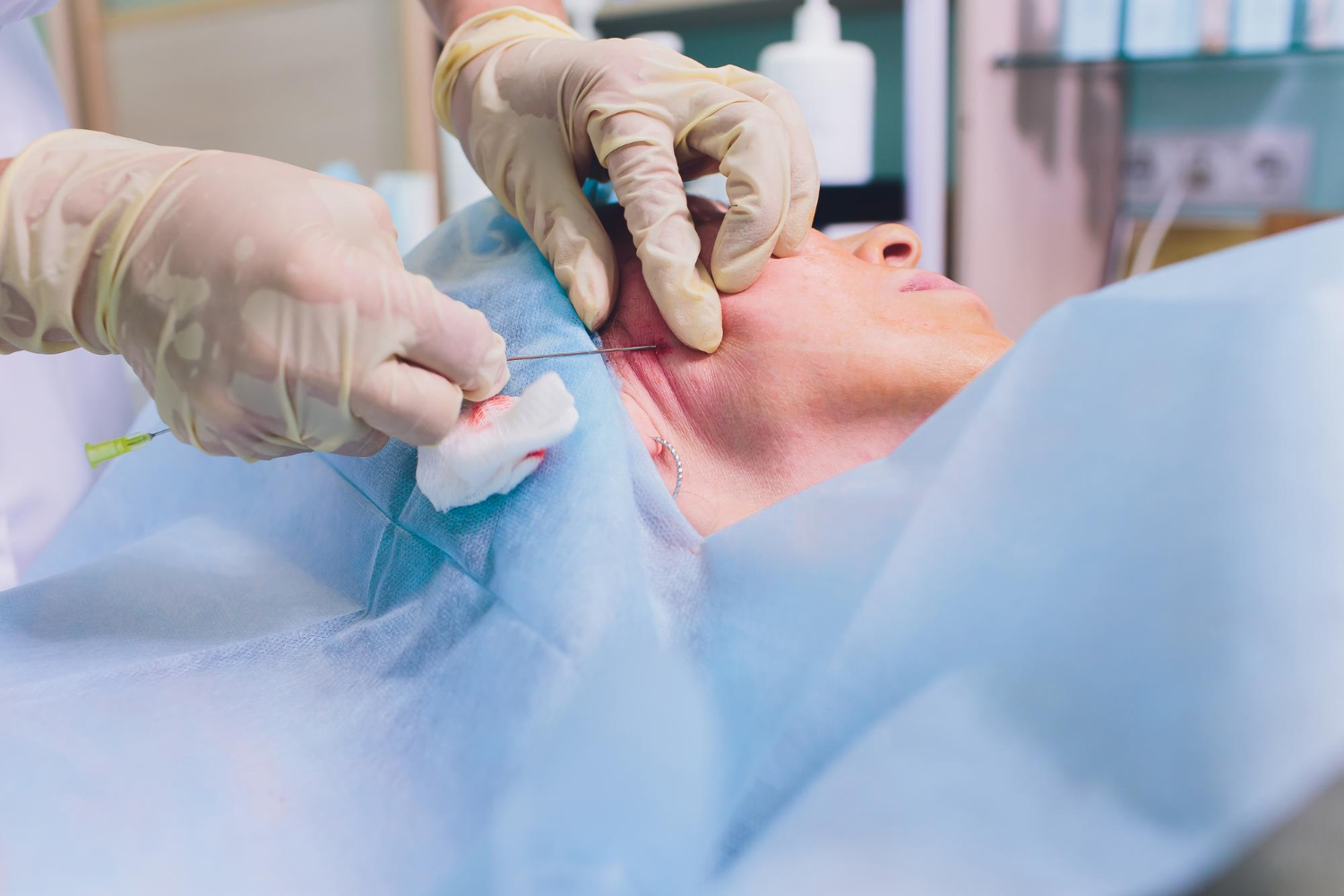 A Comprehensive Guide To Your Facelift Surgery In Dubai