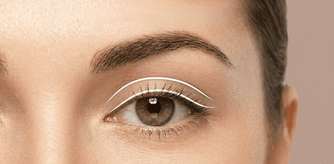 What You Need to Know About an Upper Blepharoplasty