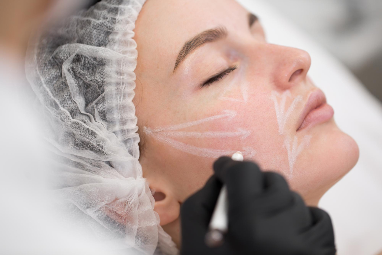 What Is A PRP Injection Facial AKA Vampire Facial
