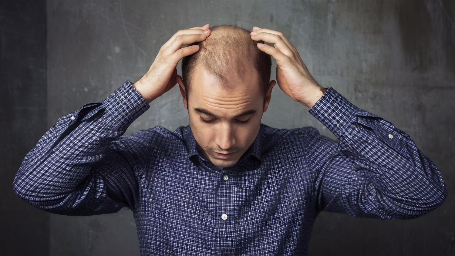 Are Hair Transplants Worth It A Comprehensive Guide
