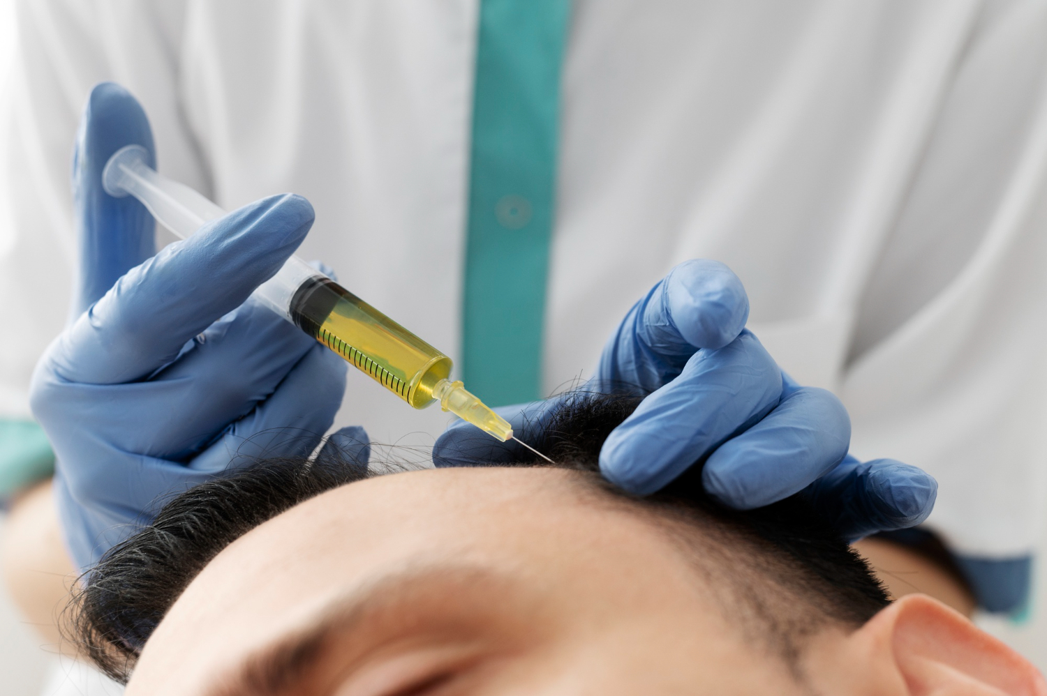 A Guide On How Does PRP Hair Treatment Work