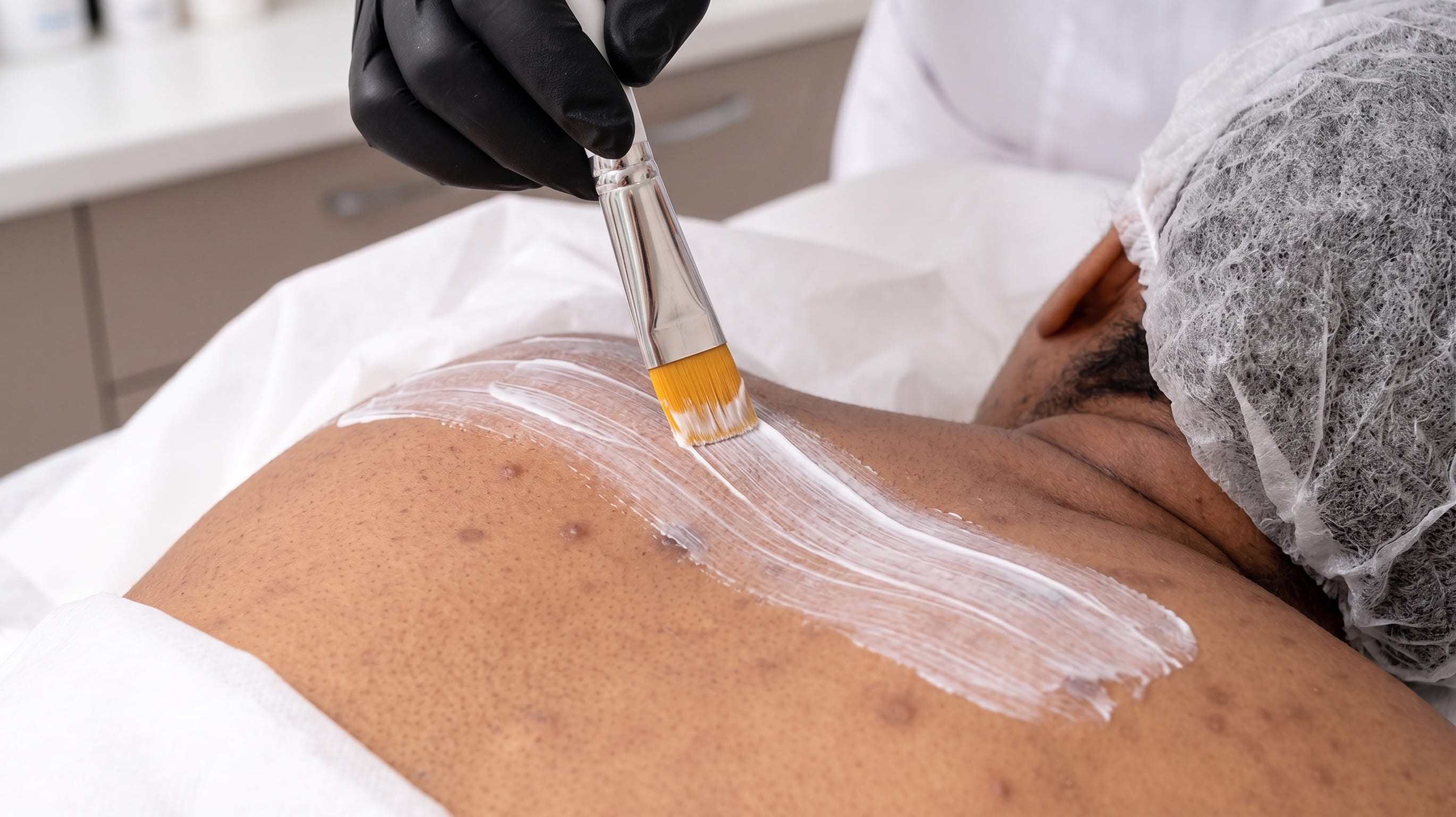 Back Facial Treatment in Dubai
