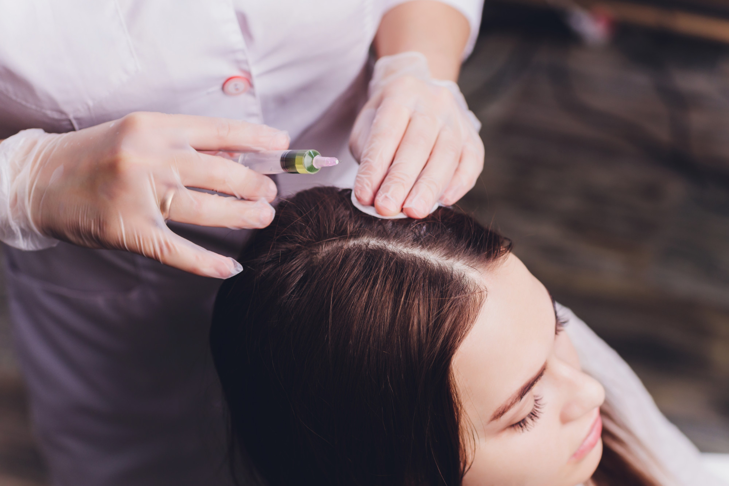 What To Expect After PRP For Hair Treatment A Complete Guide!